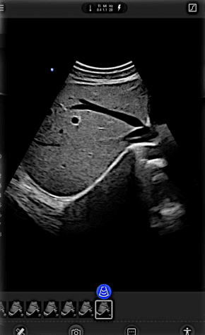 Liver Assessment
